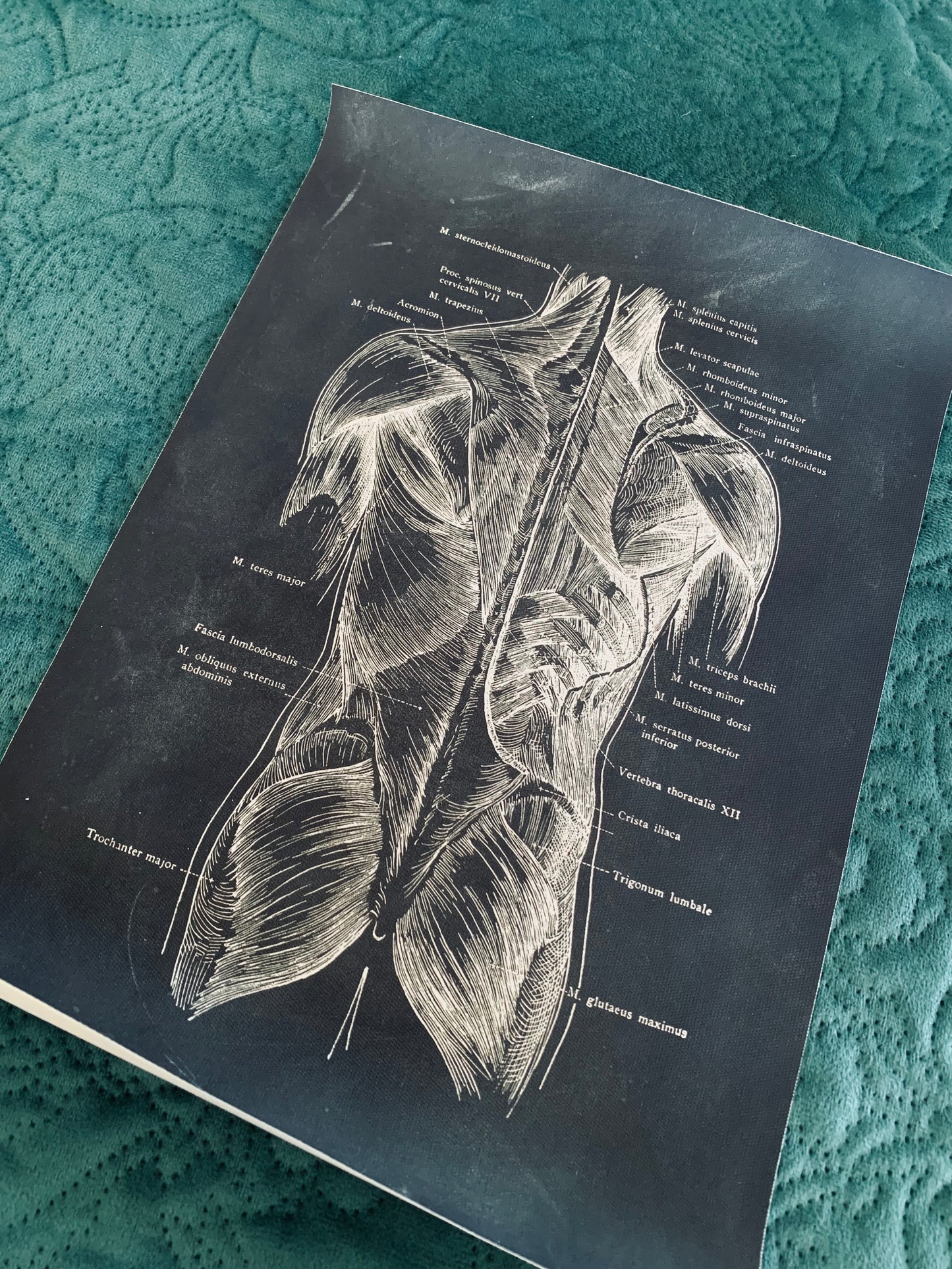 Anatomical back torso canvas print
